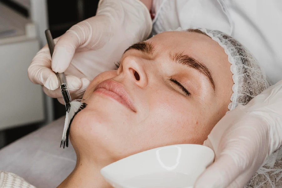 Microdermabrasion and medical chemical peel treatment at Skin Kouture