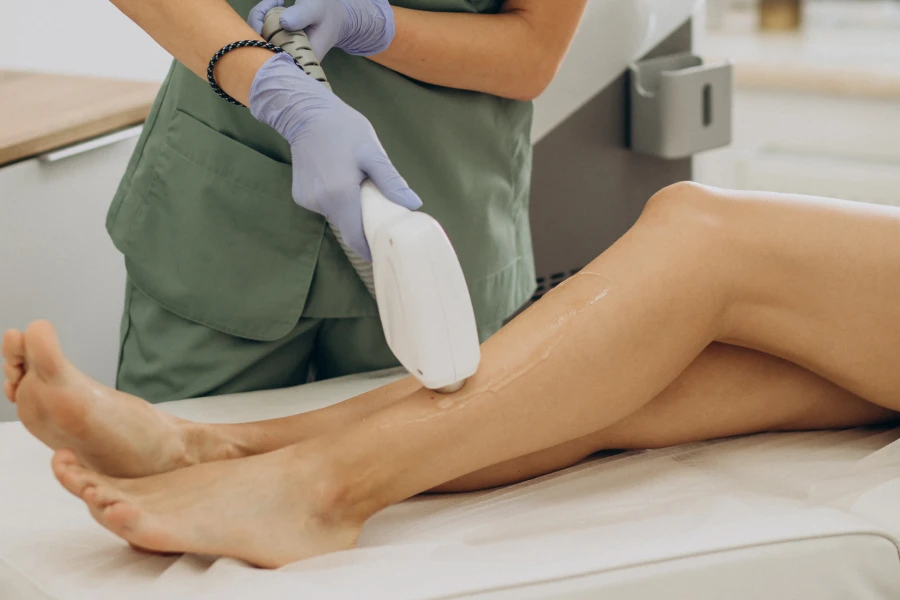 Laser vein removal results at Skin Kouture