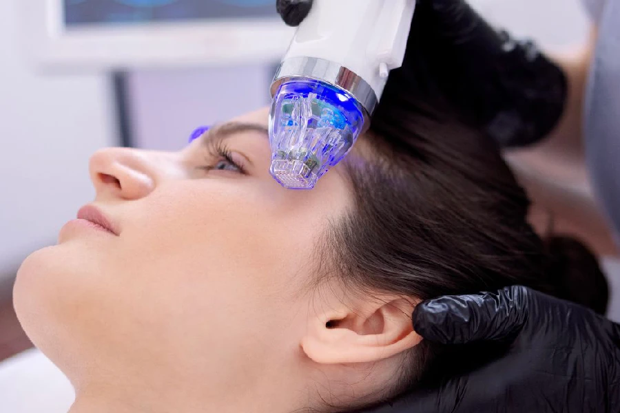 Advanced laser and light therapy for acne and scarring