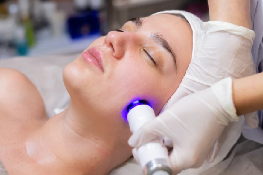 Glowing, even complexion after IPL photo facial